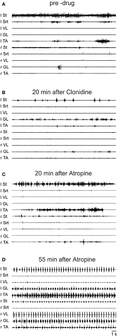 sotalol review article