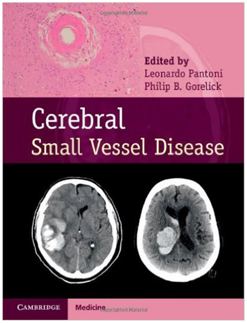 What does small vessel ischemic disease mean on an MRI?