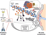 Can Smoking Trigger an Autoimmune Disease images Can Smoking Trigger an Autoimmune Disease pictures
