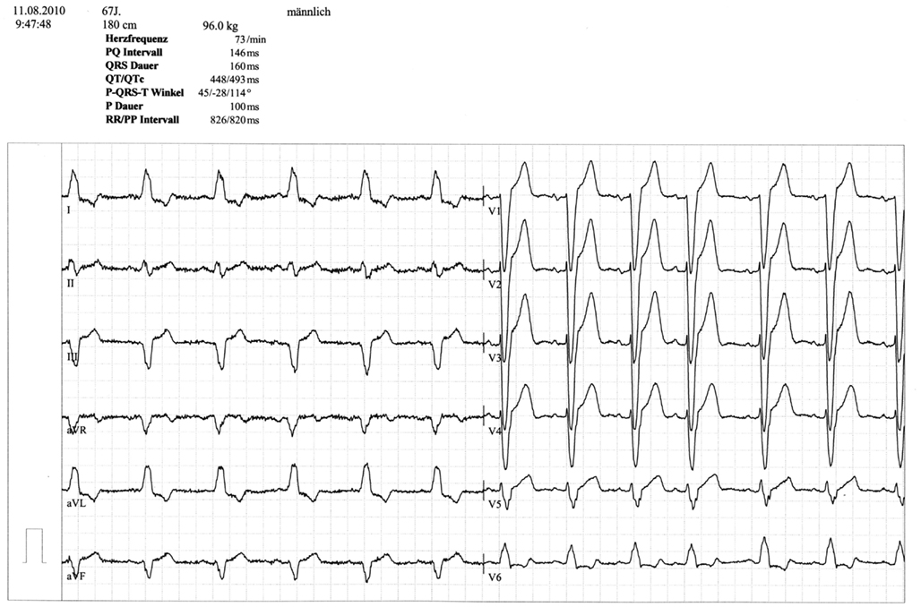 Frontiers | Transcutaneous Vagus Nerve Stimulation: Retrospective