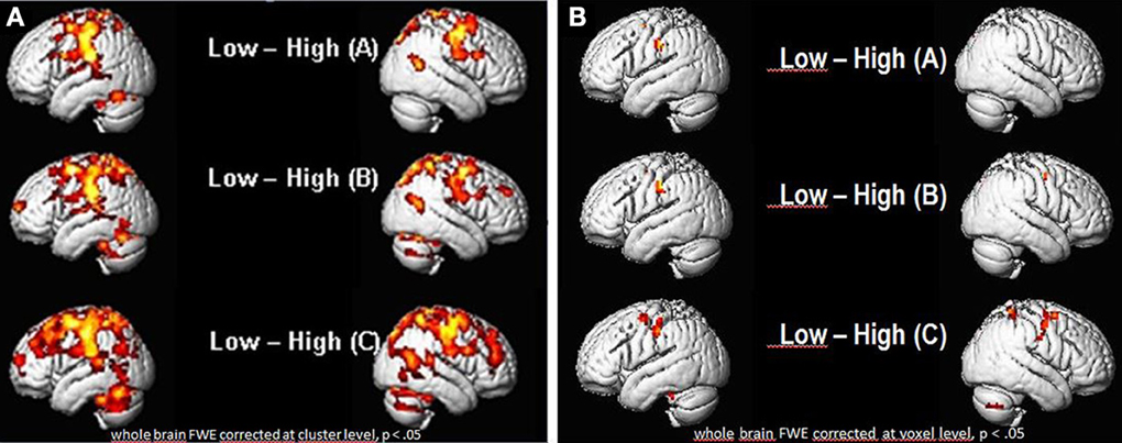 bilingual vs monolingual brain bilingual vs monolingual brain