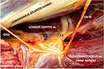 ipsilateral,ventral clinical assessment of an ipsilateral cervical spinal nerve