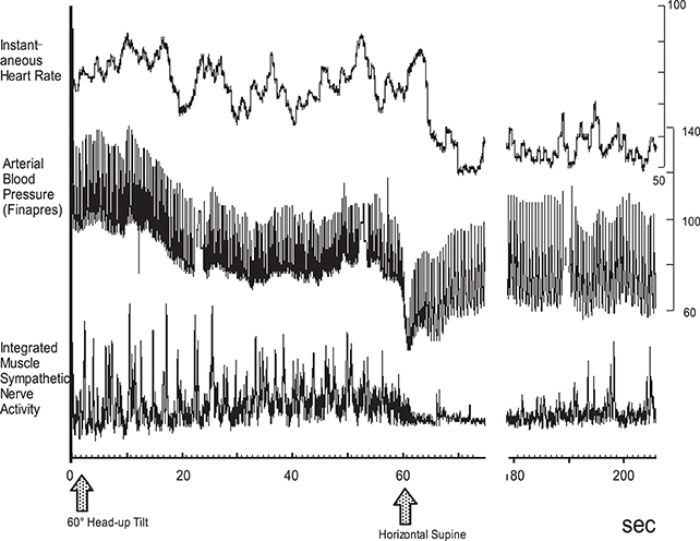 Frontiers | Role of sympathetic nerve activity in the process of