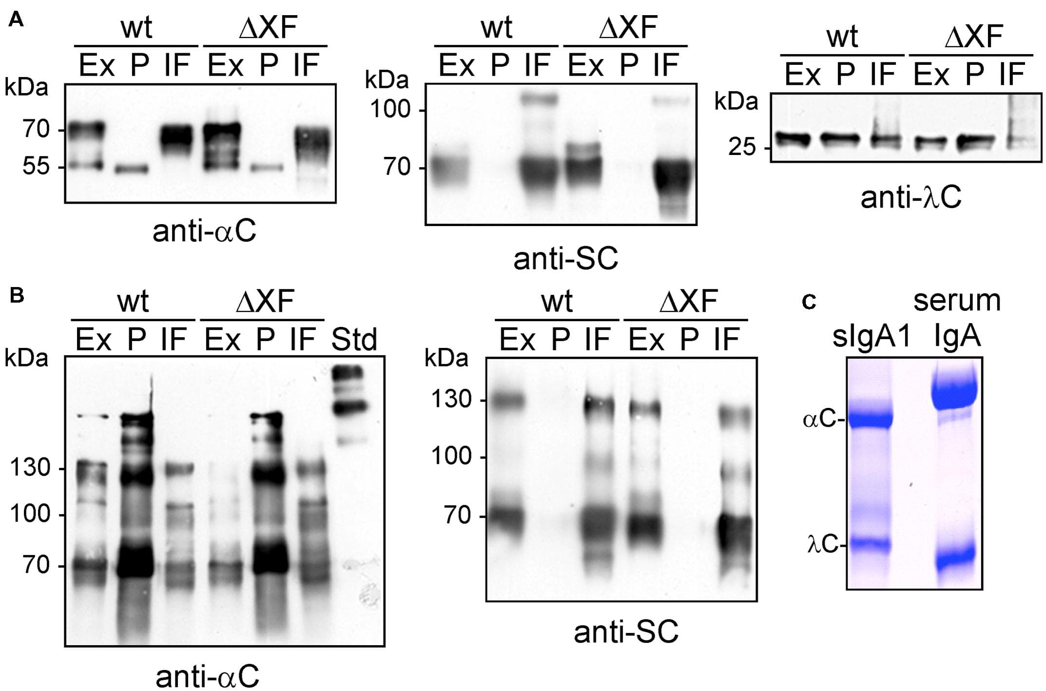 Analysis of sIgA1 expression. (A) SDS-PAGE and immunoblotting of crude protein extracts (Ex), SSL7-purified sIgA1 (P), and intercellular fluid (IF) from N. benthamiana wild-type (wt) or ΔXT/FT (ΔXF) infiltrated plants with either anti-alpha chain (anti-αC), anti-secretory component (anti-SC), or anti-lambda light chain (anti-λC) antibodies. (B) SDS-PAGE under non-reducing conditions followed by immunoblotting. (C) SDS-PAGE under reducing conditions and Coomassie staining of SSL-purified sIgA1 from plants. Human serum IgA was loaded for comparison.