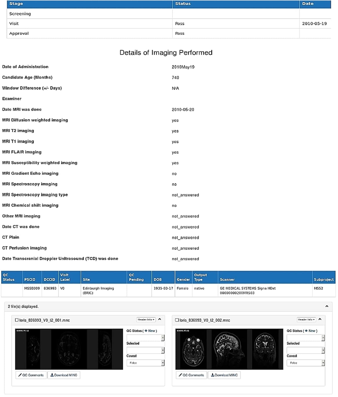 A LORIS-based web interface of the stroke image bank showing details of an anonymized patient’s imaging and clinical data as contained in the integrated database at baseline visit (visit 0).