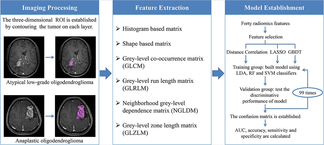 The workflow chart from image processing to model establishment. ROI, regions of interest; LASSO, least absolute shrinkage and selection operator; GBDT, gradient boosting decision tree; LDA, linear discriminant analysis; RF, random forest; SVM, support vector machine; AUC, area under the curve.