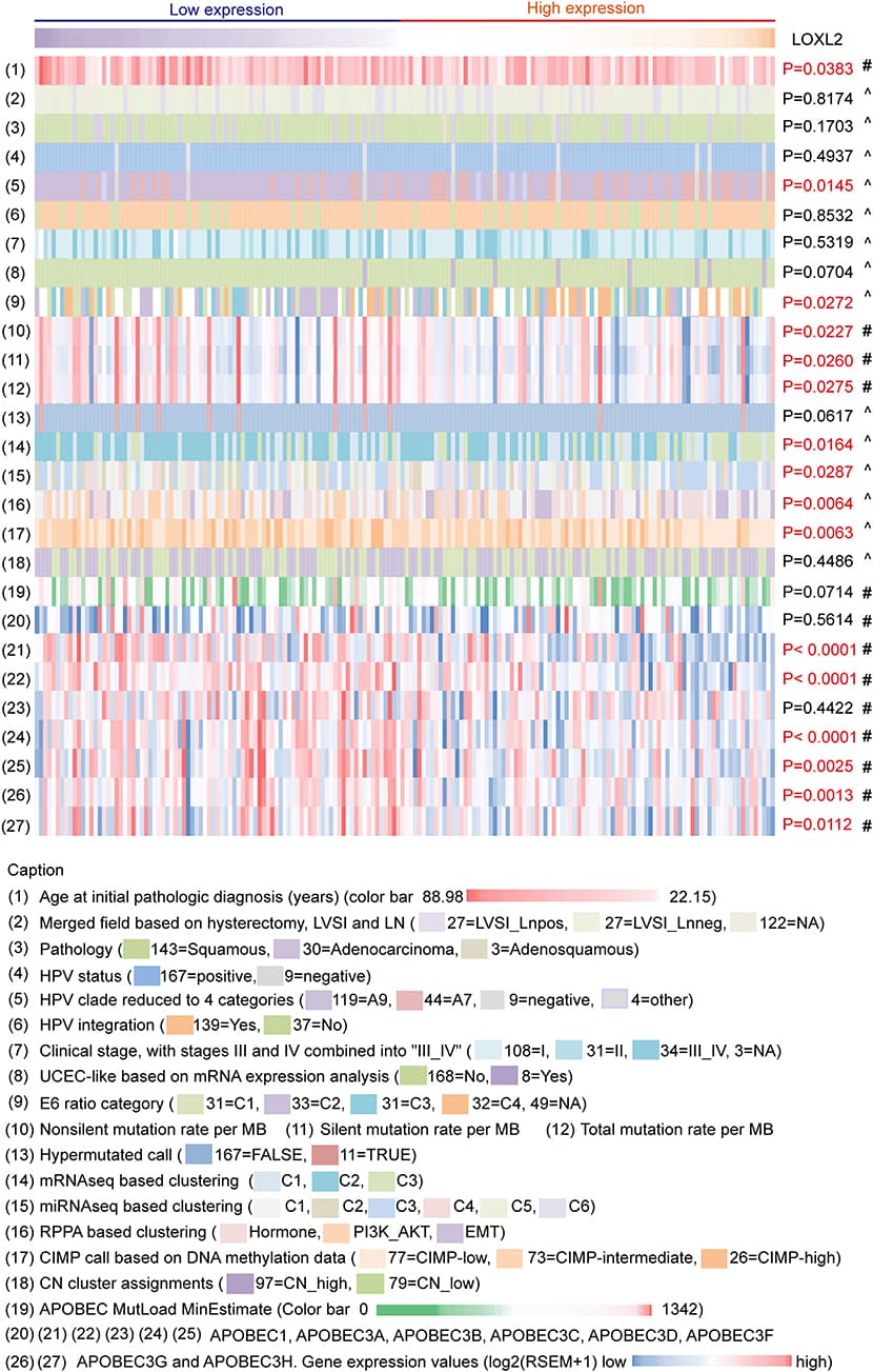 Multiplatform integrative analyses of cervical cancer data clustered by LOXL2 expression. 176 core-set cervical cancer samples were clustered into two groups according to LOXL2 mRNA expression (low LOXL2 expression, high LOXL2 expression). Clinical information, HPV genotypes of samples, somatic genomic alterations, molecular platform features corresponding to the TCGA clustering and the APOBEC3 family genes expression were showed by color. Color captions were shown in the bottom. Each column represented a sample. #P-values were calculated by Mann–Whitney test. ∧P values were calculated by Chi-Square Test. Red P-values indicate P < 0.05.