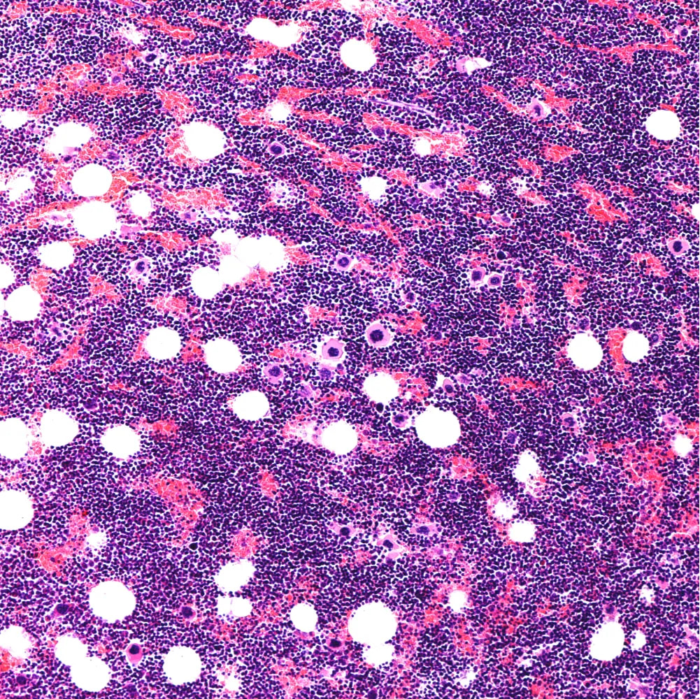 Cover image for research topic "Critical Complications In Pediatric Oncology and Hematopoietic Cell Transplant"