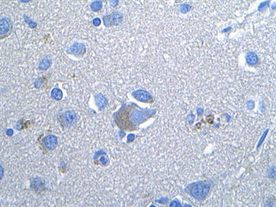 Cover image for research topic "The Role of Cellular Senescence in Health and Disease"