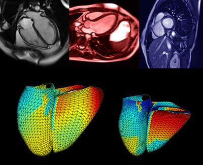 Cover image for research topic "Current and Future Role of Artificial Intelligence in Cardiac Imaging"