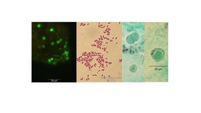 Cover image for research topic "Recent Advances in the Controversial Human Pathogens Pneumocystis, Microsporidia and Blastocystis"