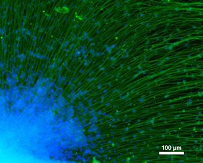 Cover image for research topic "Advances in Cell and Gene Therapy in Treating Neural Diseases"