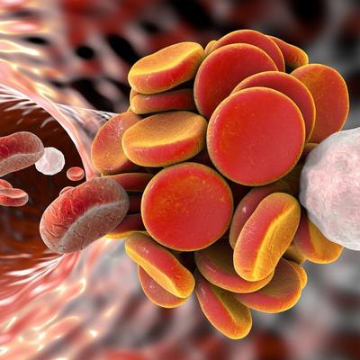 Cover image for research topic "Management of Arterial and Venous Thrombosis in Cancer Patients"