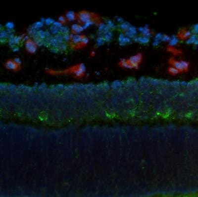 Cover image for research topic "Novel Therapeutic Target and Drug Development in Neurovascular Retinal Diseases"