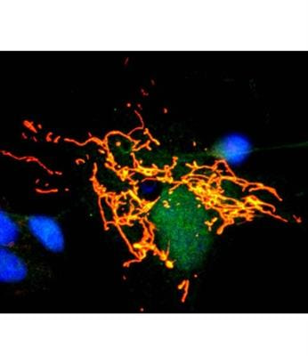 Cover image for research topic "Mitochondrial Proteomics: Understanding Mitochondria Function and Dysfunction Through the Characterization of Their Proteome"