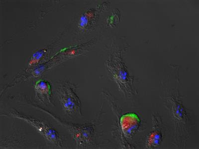 Cover image for research topic "TRP Channels in Inflammation and Immunity"