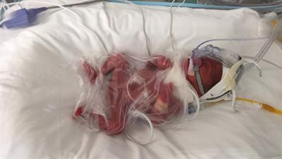 Cover image for research topic "Respiratory Management of Extremely Preterm Infants"
