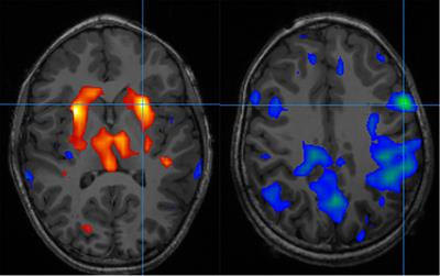 Cover image for research topic "Brain Mechanisms Linking Sleep and Epilepsy"