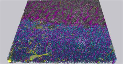Cover image for research topic "Advanced Imaging Methods in Neuroscience"