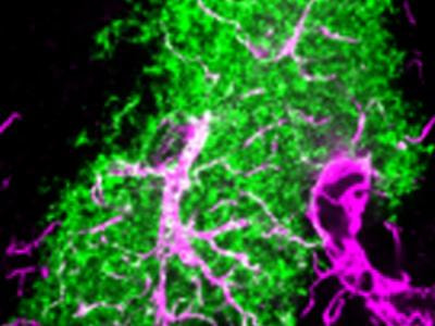 Cover image for research topic "Imaging and monitoring astrocytes in health and disease"