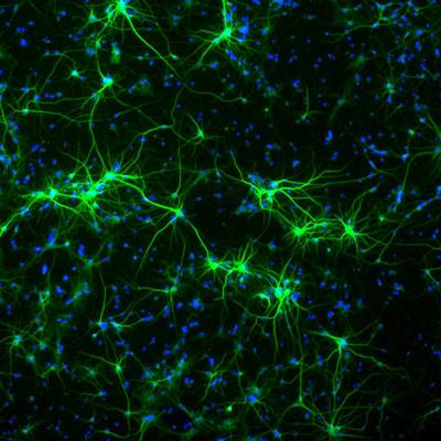 Cover image for research topic "Mechanisms of Neuronal Recovery in the Central Nervous System"