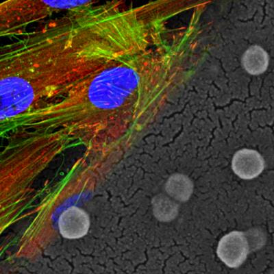 Cover image for research topic "Antioxidant Nanomedicine"