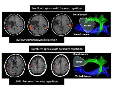 Cover image for research topic "Dissecting the function of networks underpinning language repetition"
