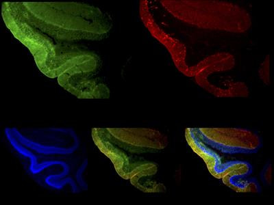 Cover image for research topic "Impact of Neuromodulation During Development, Adulthood and Aging"