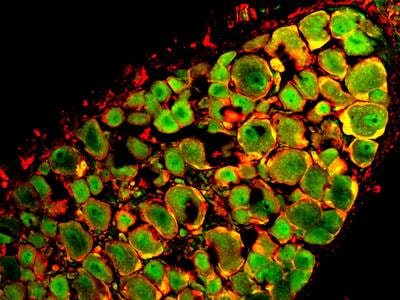 Cover image for research topic "Sensory Abnormalities and Primary Sensory Neurons"