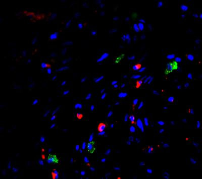 Cover image for research topic "Reprogramming Stromal Cells in Chronic Inflammation and Cancer"