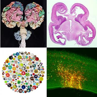 Cover image for research topic "What does Human Pathology Bring to the Understanding of the Fundamental Mechanisms of Development?"
