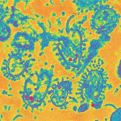 Cover image for research topic "Secondary Effects of Antibiotic Exposure"