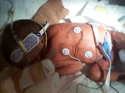 Cover image for research topic "Organ Perfusion and Oxygenation in the Sick Infant"