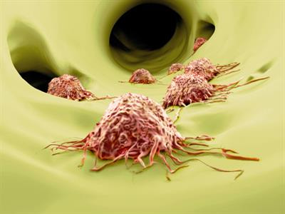 Cover image for research topic "Tumor Microenvironment: Molecular Mechanisms and Signaling Pathways Involved in Metastatic Progression"