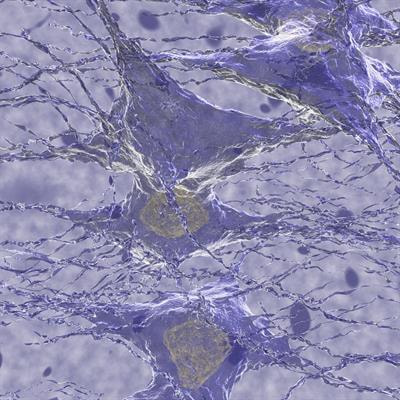 Cover image for research topic "Novel Diagnostic and Therapeutic Strategies in the Management of Cerebral Gliomas
"
