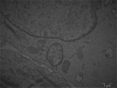 Cover image for research topic "How do Metabolism, Angiogenesis, and Hypoxia Modulate Resistance?"