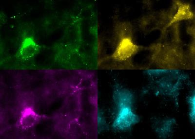 Cover image for research topic "Neuromodulatory Function in Auditory Processing"