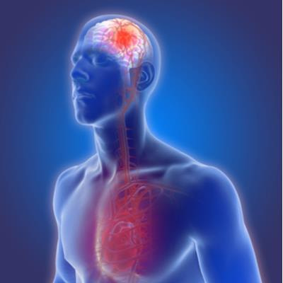 Cover image for research topic "Current Challenges in Cardioembolic Stroke"