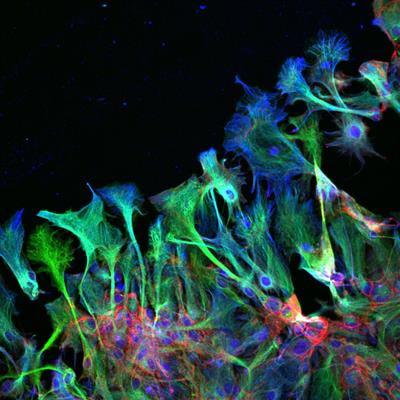 Cover image for research topic "Molecular Mechanisms of Glia in Development and Disease"