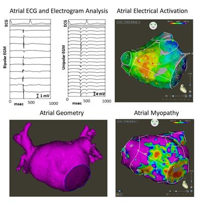 Cover image for research topic "Electrical and Structural Remodelling in Atrial Fibrillation: Phenotypes for Personalized therapy"