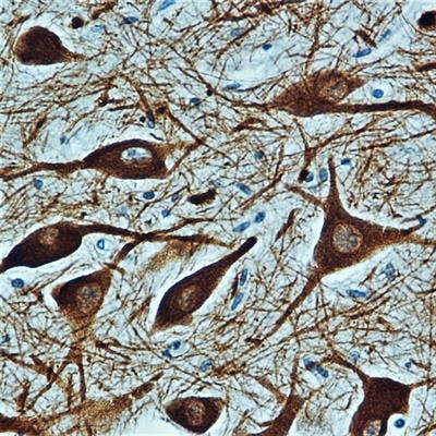 Cover image for research topic "Updates on the Neuropathology of Sudden Unexplained Perinatal Death and other Neurodevelopmental Disorders"