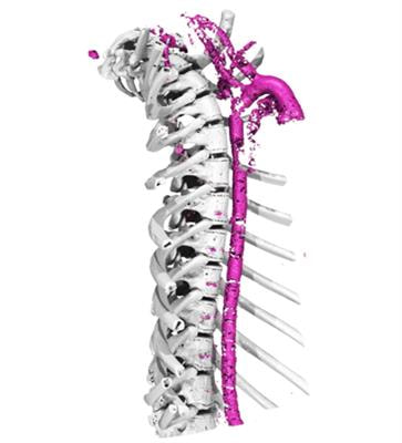 Cover image for research topic "Ectopic Mineralization of Tissues: Mechanisms, Risk Factors, Diseases and Prevention"