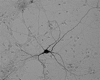 Cover image for research topic "Excitotoxicity Turns 50"