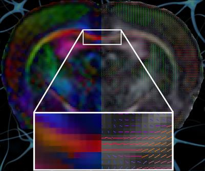 Cover image for research topic "Community Series in Advanced PET, SPECT, MR and Optical Imaging in Clinical and Pre-Clinical Research of Neuropsychiatric Disorders - Volume I"