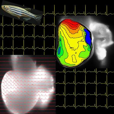 Cover image for research topic "Clinical Relevance of the Zebrafish Heart as a Model for Human Cardiac Arrhythmogenesis and Cardiomyopathies"
