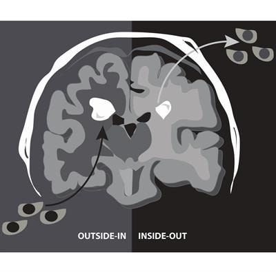 Cover image for research topic "“Inside-out” vs “Outside-in” Paradigms in Multiple Sclerosis Etiopathogenesis"