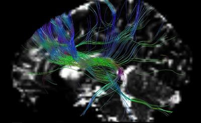 Cover image for research topic "New Paradigm of Attention and Attention Training: Mechanisms and Applications"