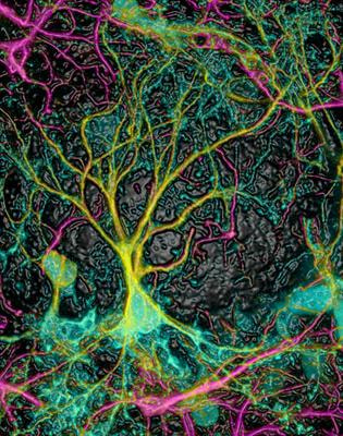 Cover image for research topic "Neurogenesis and Gliogenesis as Potential Contributors to Neurorepair after Brain Damage"