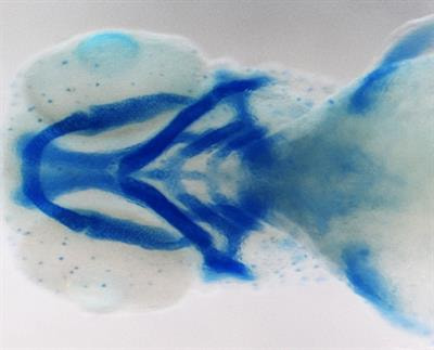 Cover image for research topic "Genetic, Environmental and Synergistic Gene-Environment Contributions to Craniofacial Defects"