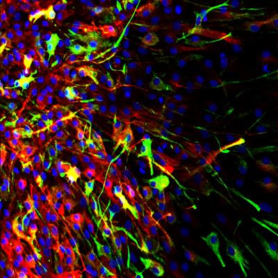Cover image for research topic "New Insights into Adult Neurogenesis and Neurodegeneration: Challenges for Brain Repair"